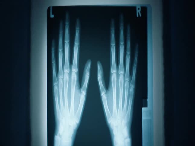 An x-ray of a person's hands is illuminated
