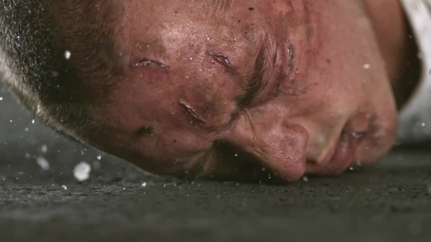 Injured man's face as he hits the ground