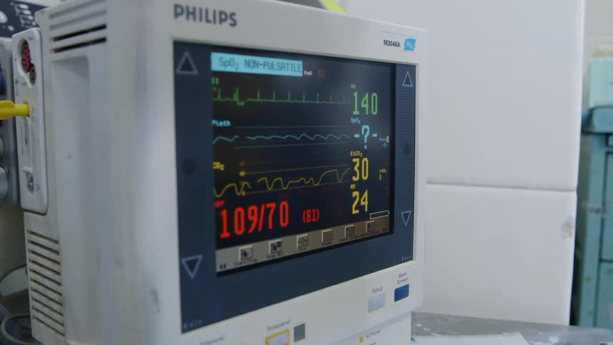 Medical monitor in a hospital room