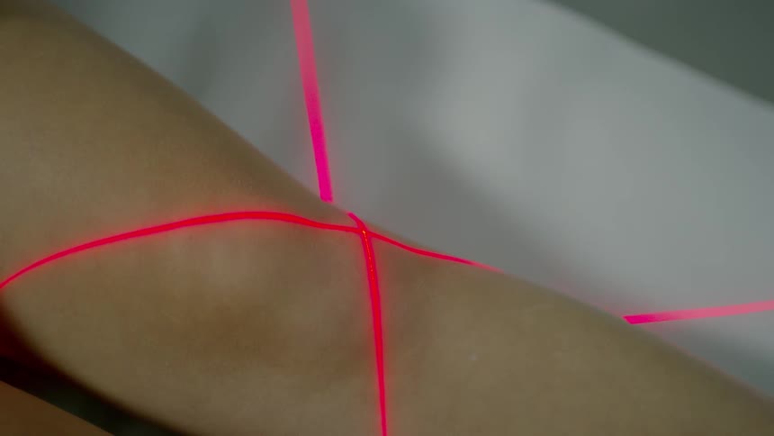 Grid lasers mark the knee of a person