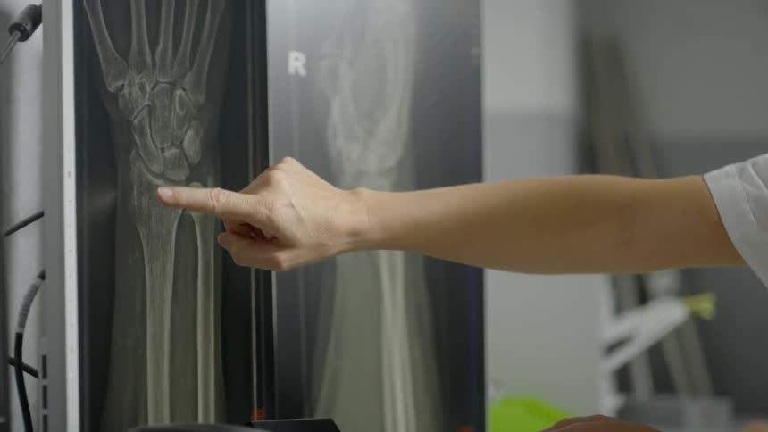 A doctor points at x-rays