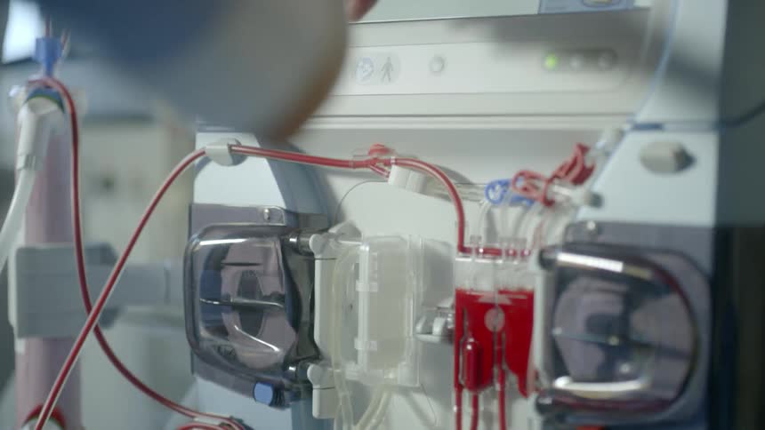 A blood transfusion machine is being used by a doctor