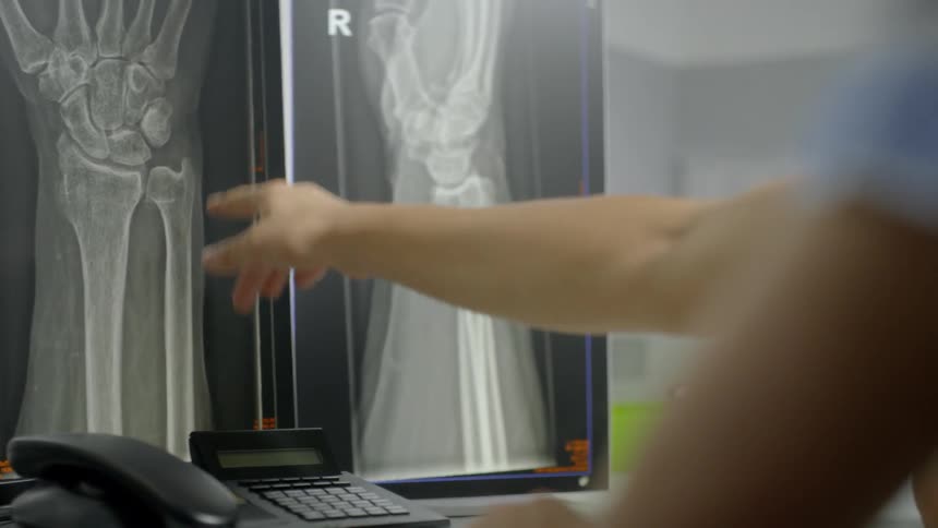 A physician is pointing out features of an x-ray to a student