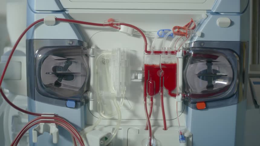 A blood machine is processing blood through tubes