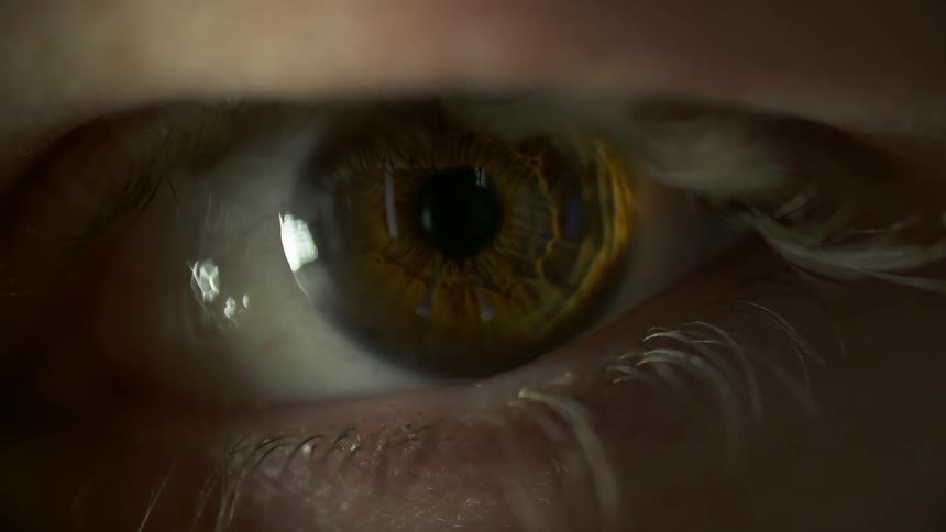 An eye is tracking back and forth as a light shines near it