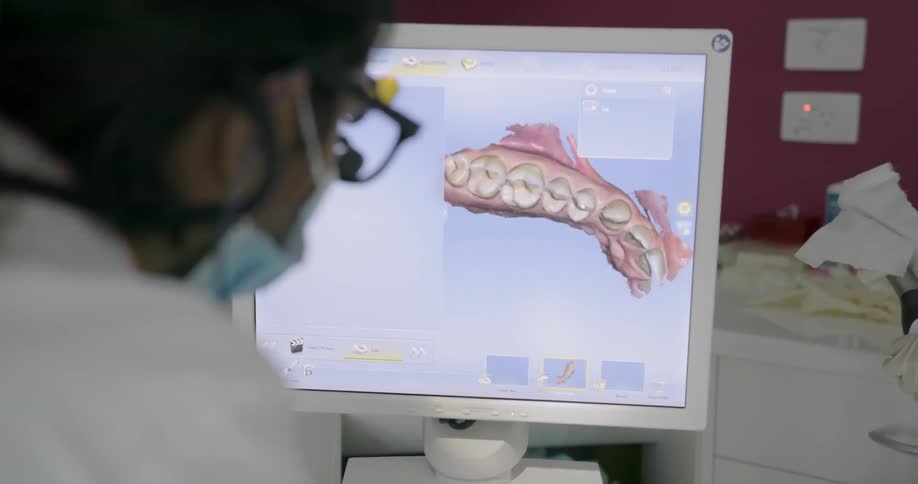 A dentist looks at a diagram of someone's teeth on the monitor