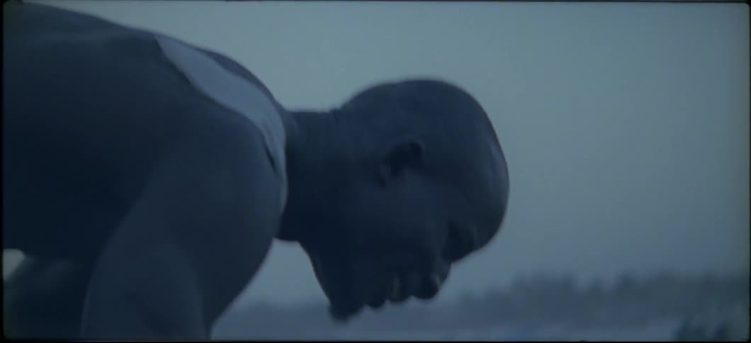 A man is standing on the beach and has a shoulder bandage on
