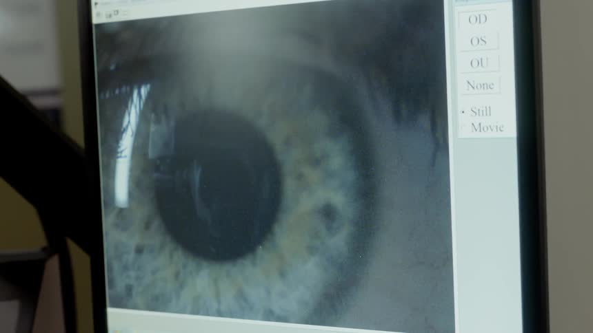 An optometrist examines an eye