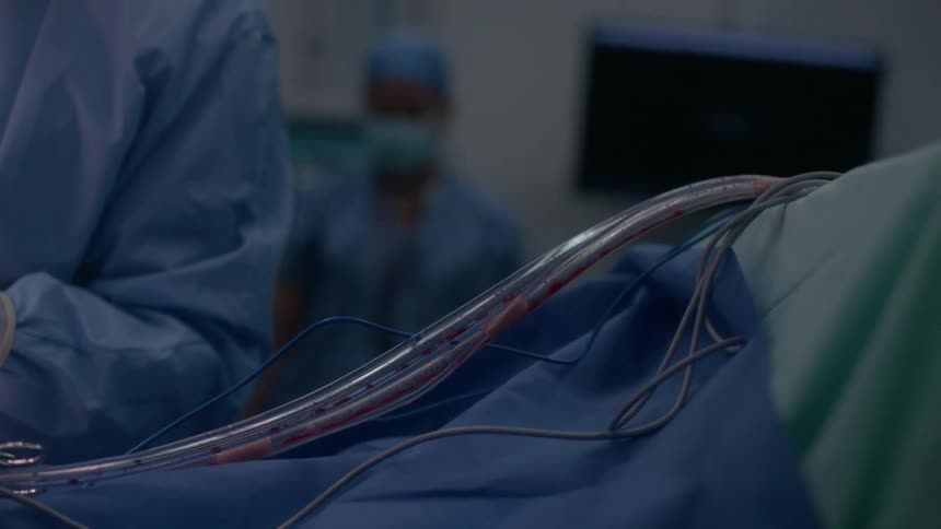 Tubes are draining fluid from a patient in an operating room