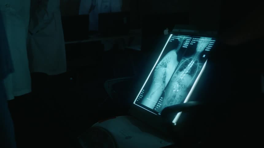 People walk past a picture of an x-ray