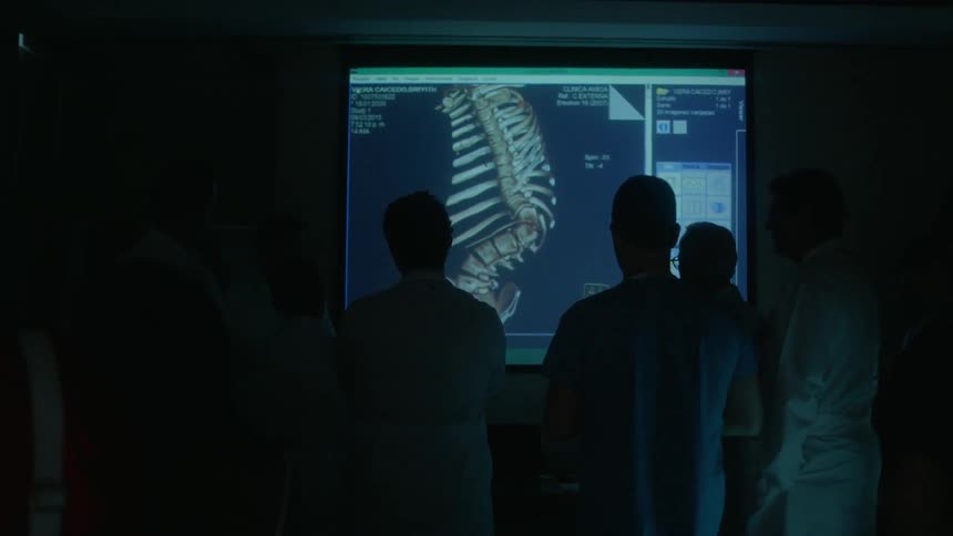 Doctors gather around a screen displaying bones