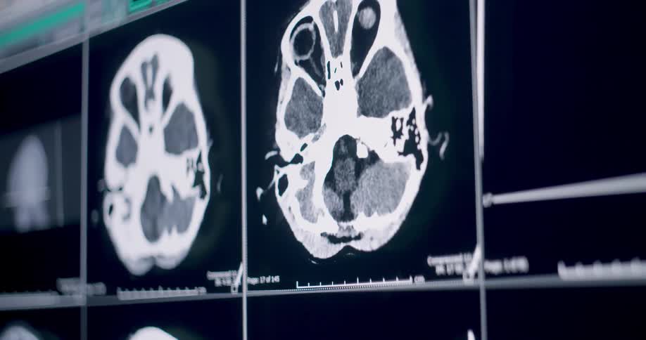 Medical images of a brain scan are displayed on a monitor