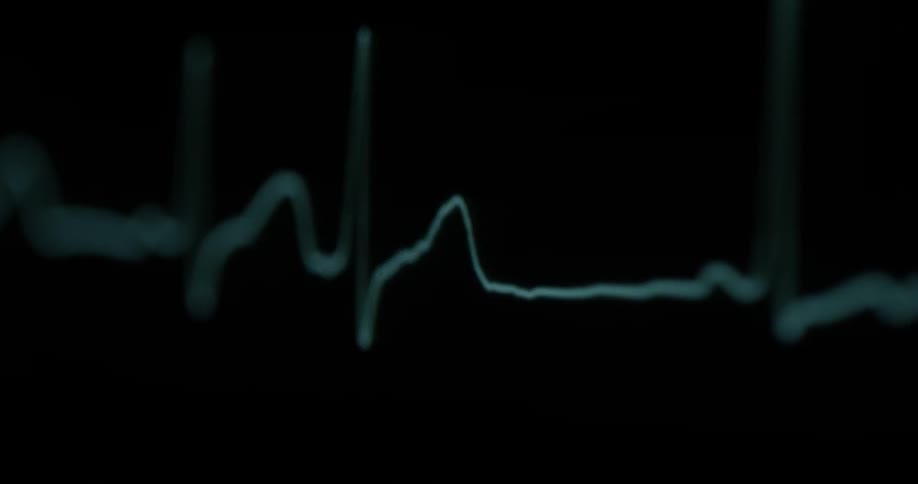 A heartbeat is displayed on a monitor
