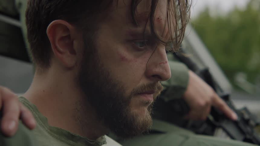 A man with cuts and bruises on his face rides in the back of a truck