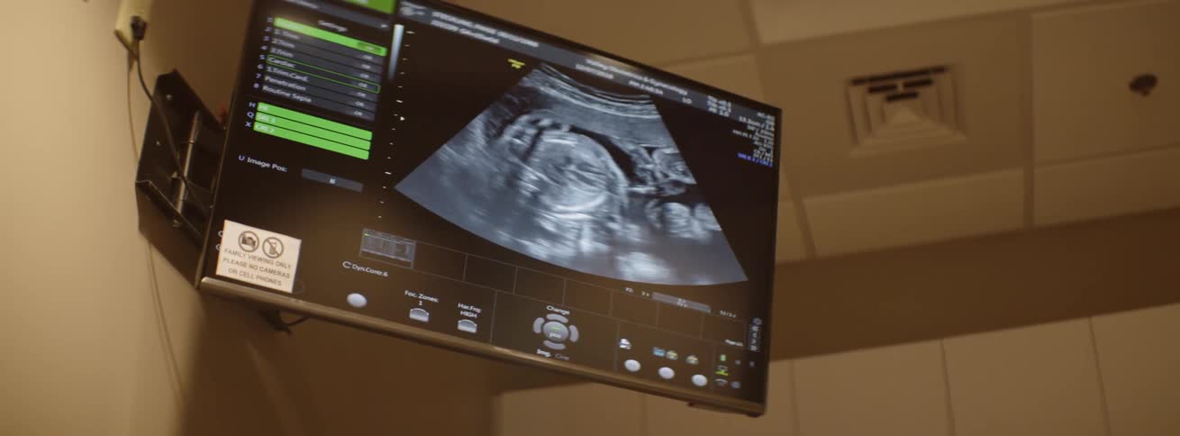 A fetus is shown on an ultrasound