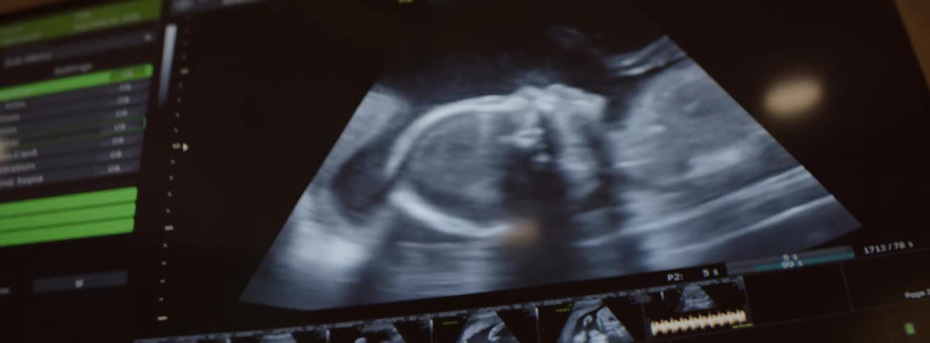 The ultrasound film of a baby in the womb