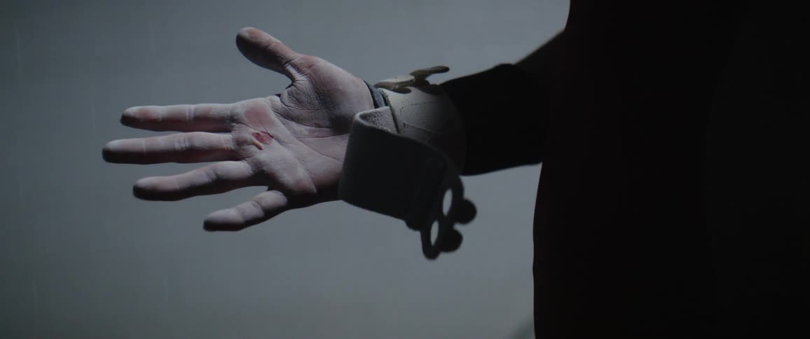 Man's hand with a cut on it