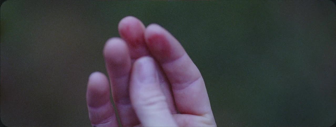 Person's hand with blood stains on two fingers