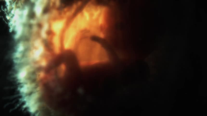 Baby inside of womb