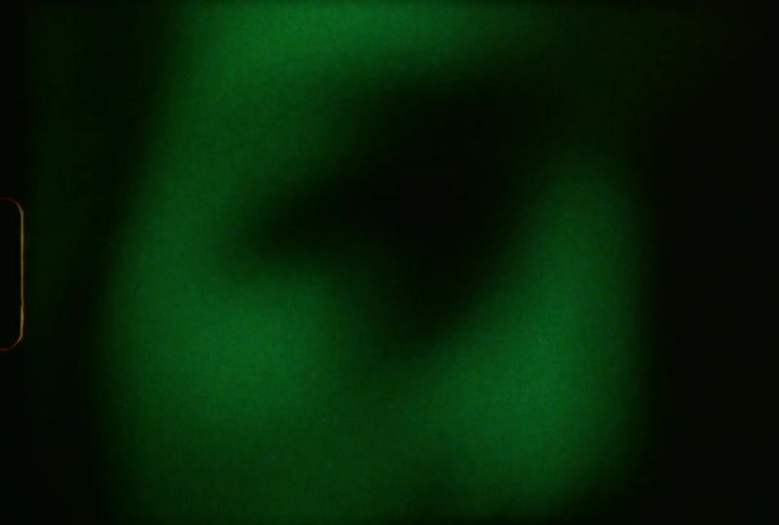 A person's face is visible while different colors flash