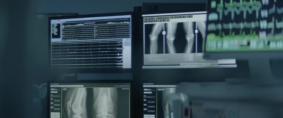 Several monitors display text and x rays