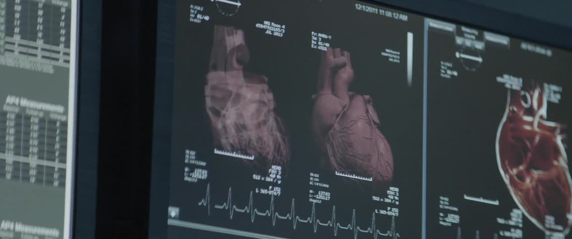 Medical diagnostic imagery is shown on the screens
