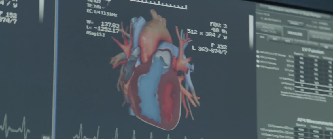 Screens of hearts beating