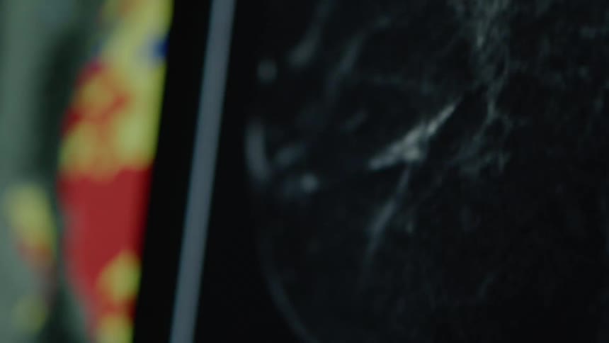 Medical scan imagery is displayed on the screens