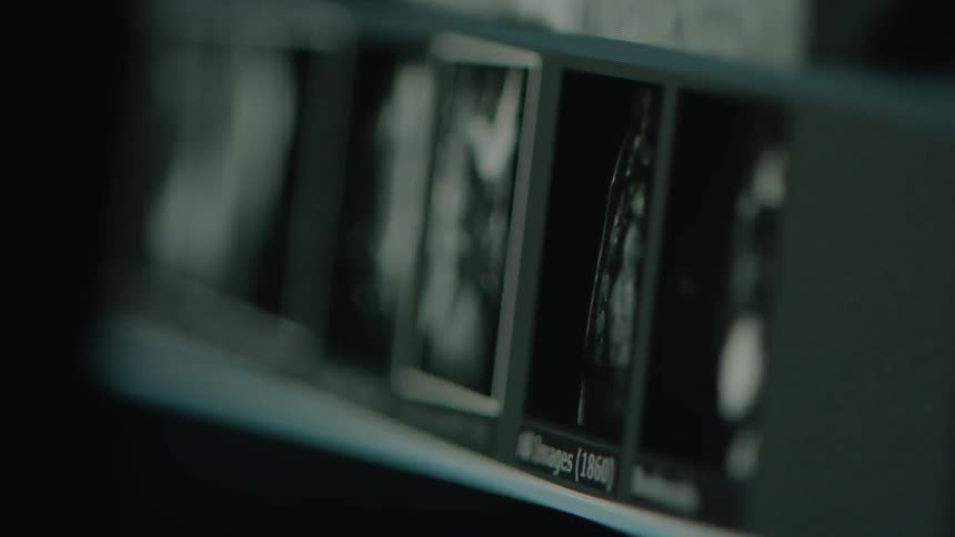 Medical diagnostic imagery is shown on the screens