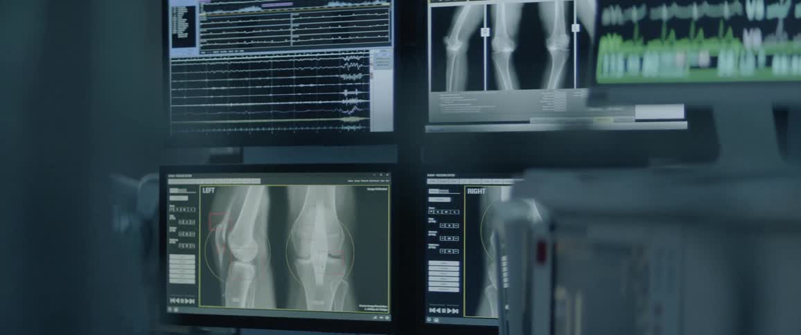 Medical scan imagery is displayed on the screens