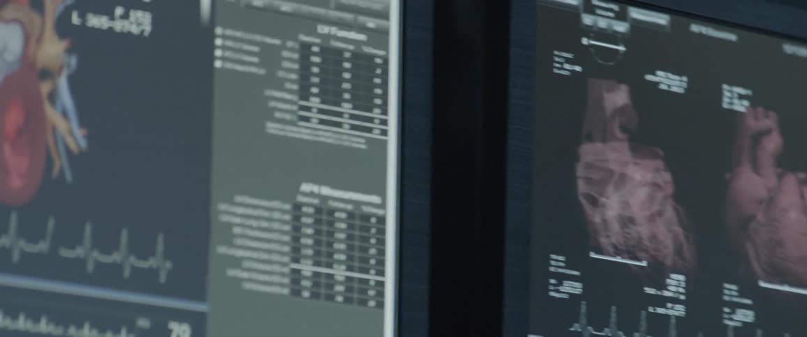 Heart vitals are displayed on a monitor in a hospital