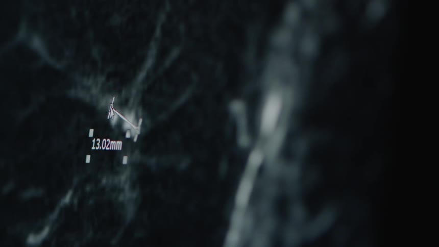 An image is notated on a screen