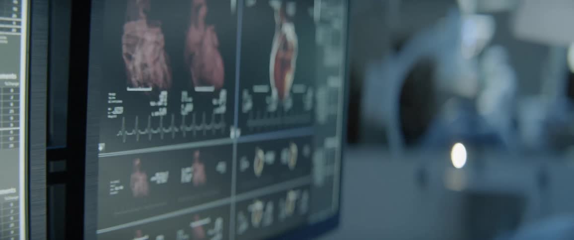 A heart beats on a monitor in a hospital