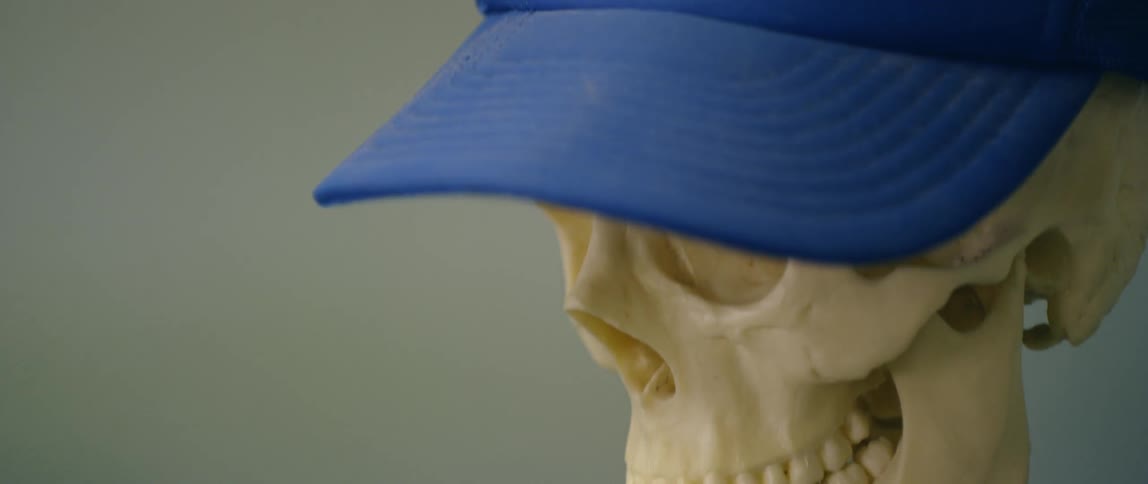 A blue baseball cap on a human skull