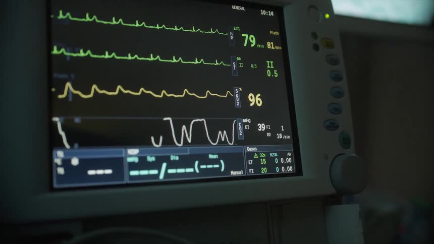 An electronic graph on a machine in the hospital