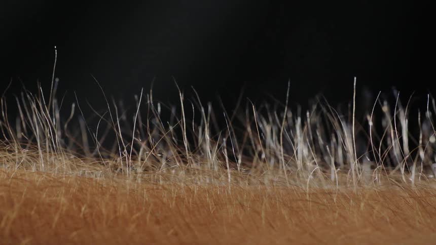 Hair standing up on skin