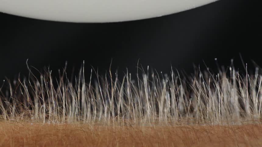 Hair on an arm stands up straight