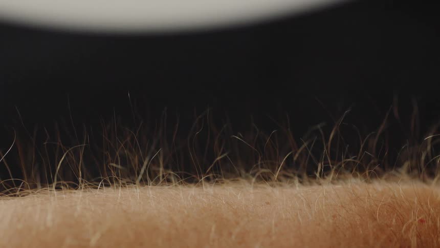 Hair stands up on a person's arm