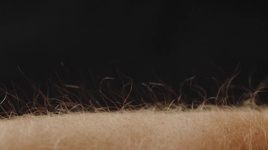 Some hair standing up on a person's arm
