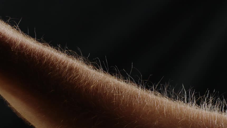 Hair stands up on a person's arm due to static electricity