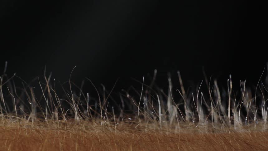 Hair standing up on skin