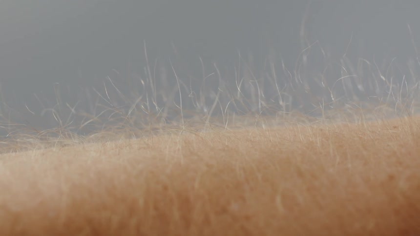 Hair on an arm stands up straight