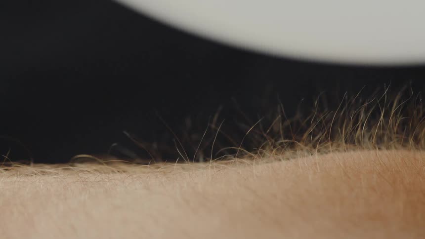 Static Electricity On A Person's Arm