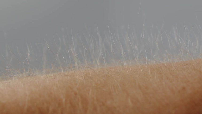 Static Electricity On A Person's Arm