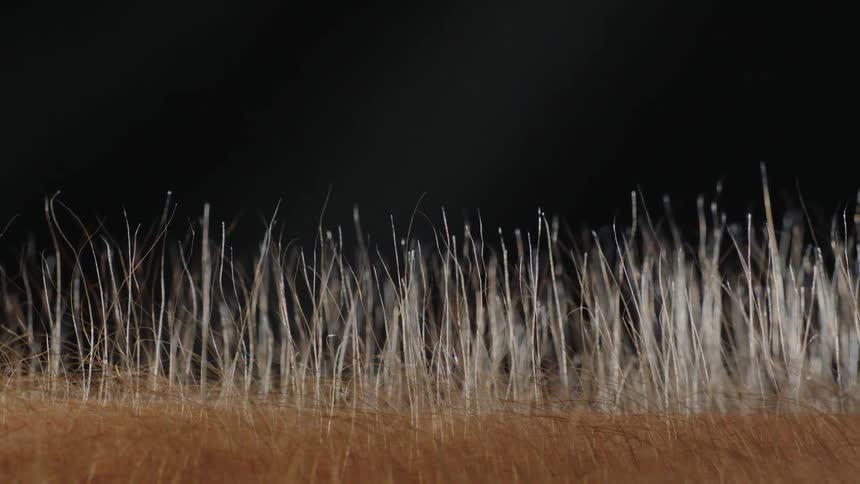 Hair standing up on a person's arms
