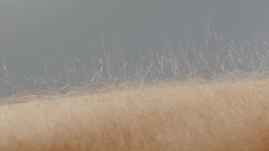 Static Electricity On A Person's Arm