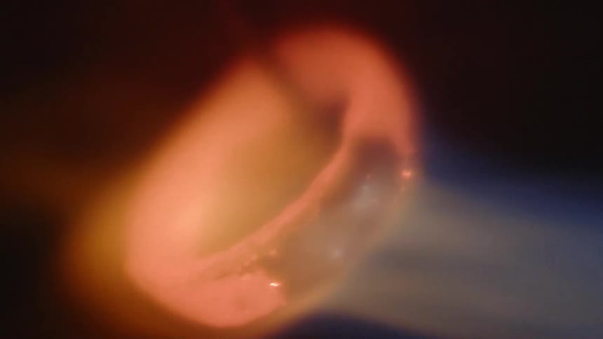 Metal is heated by flame