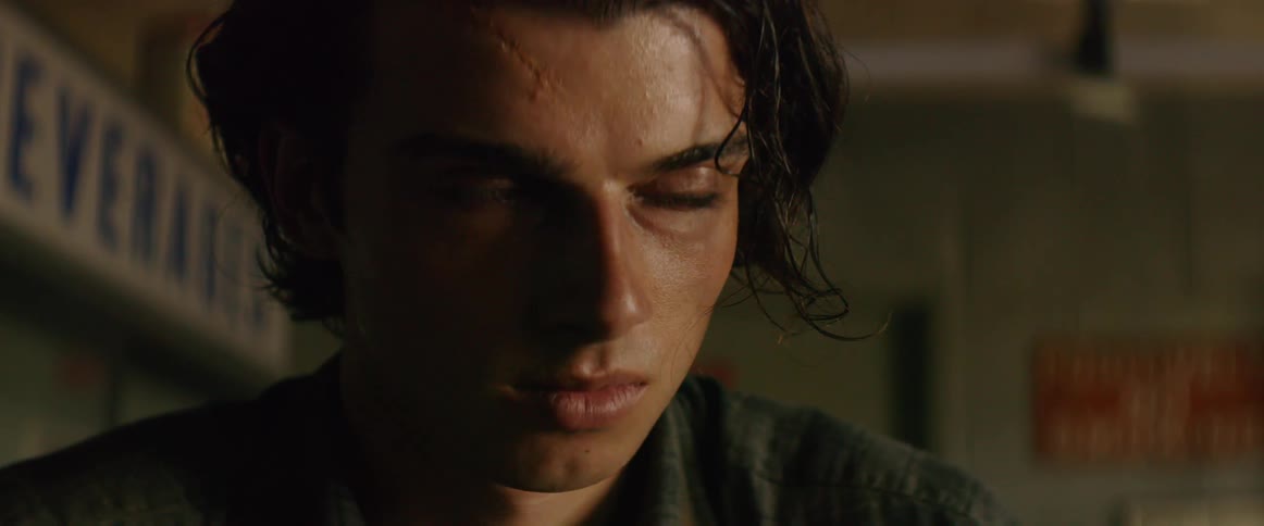 A man's eyes move under his lids as if having a seizure