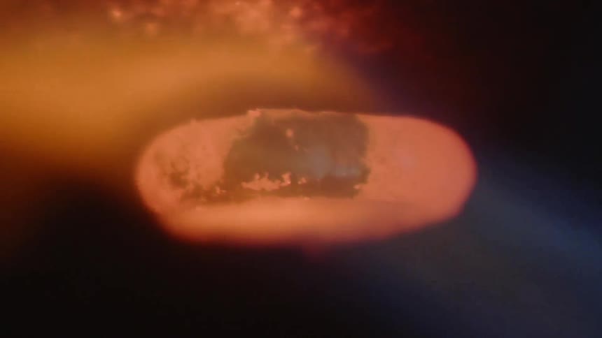 A metal ring is being melted with fire