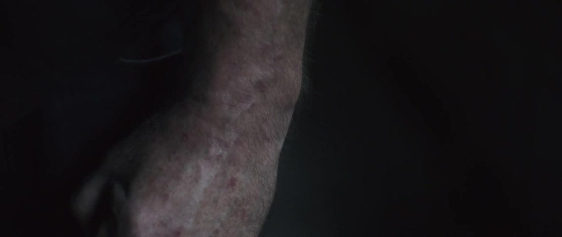 A man clenches his fists repeatedly